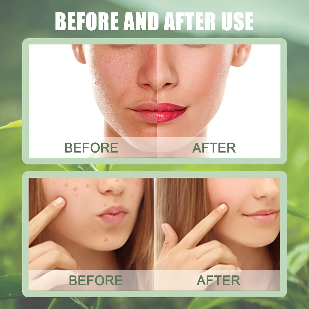 BIOSKIN™ - Natural Green Tea Mask